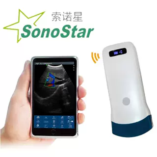 索诺星Sonostar 厂家直销 销 无线掌上超声 腹部掌超 询单问价
