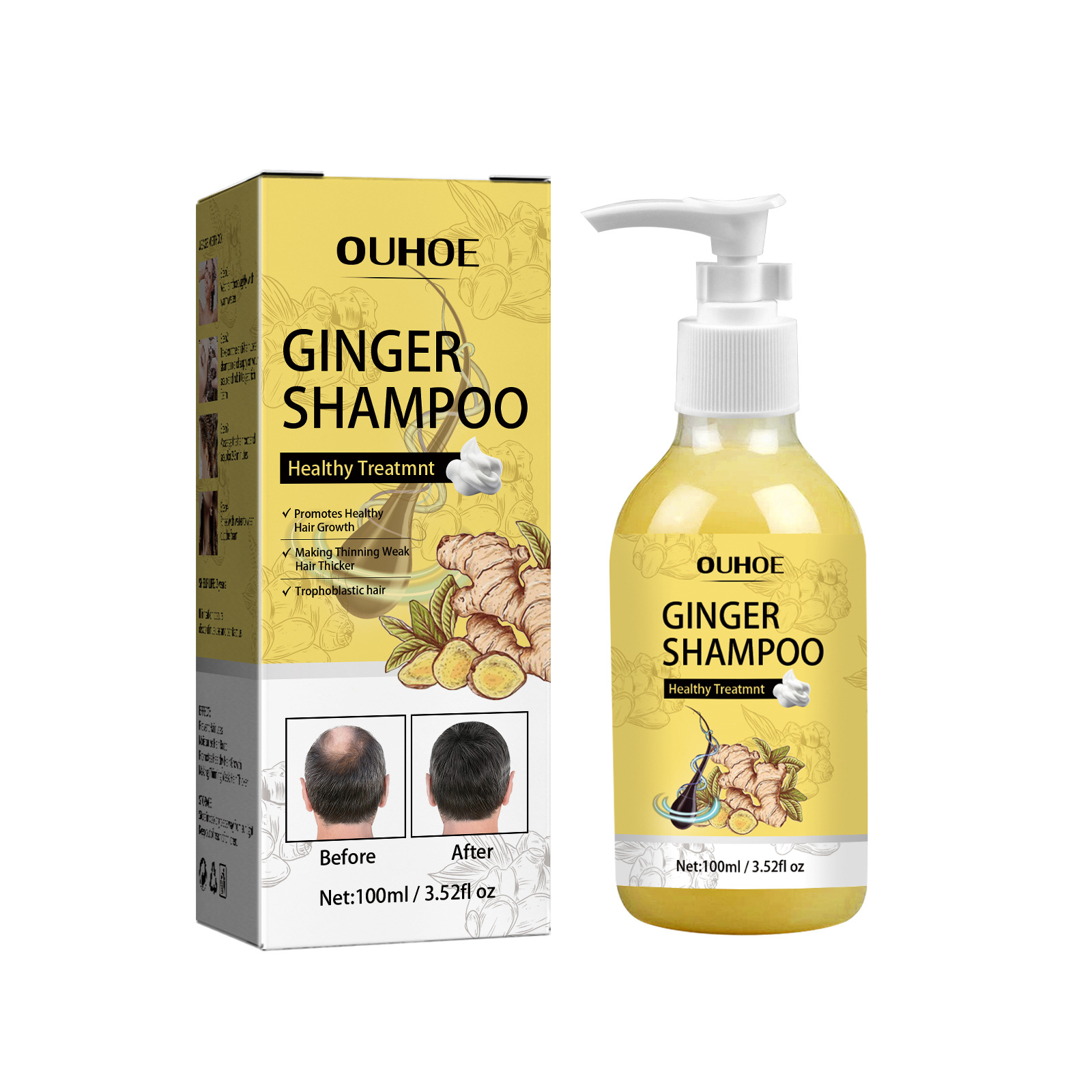 OUHOE Ginger Dense pour shampooing anti-démangeaisons, raffermissant, croissance, hydratant et moelleux_voghion.com