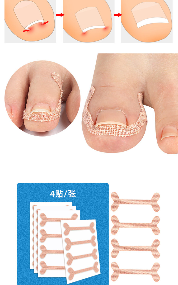 неопределенный