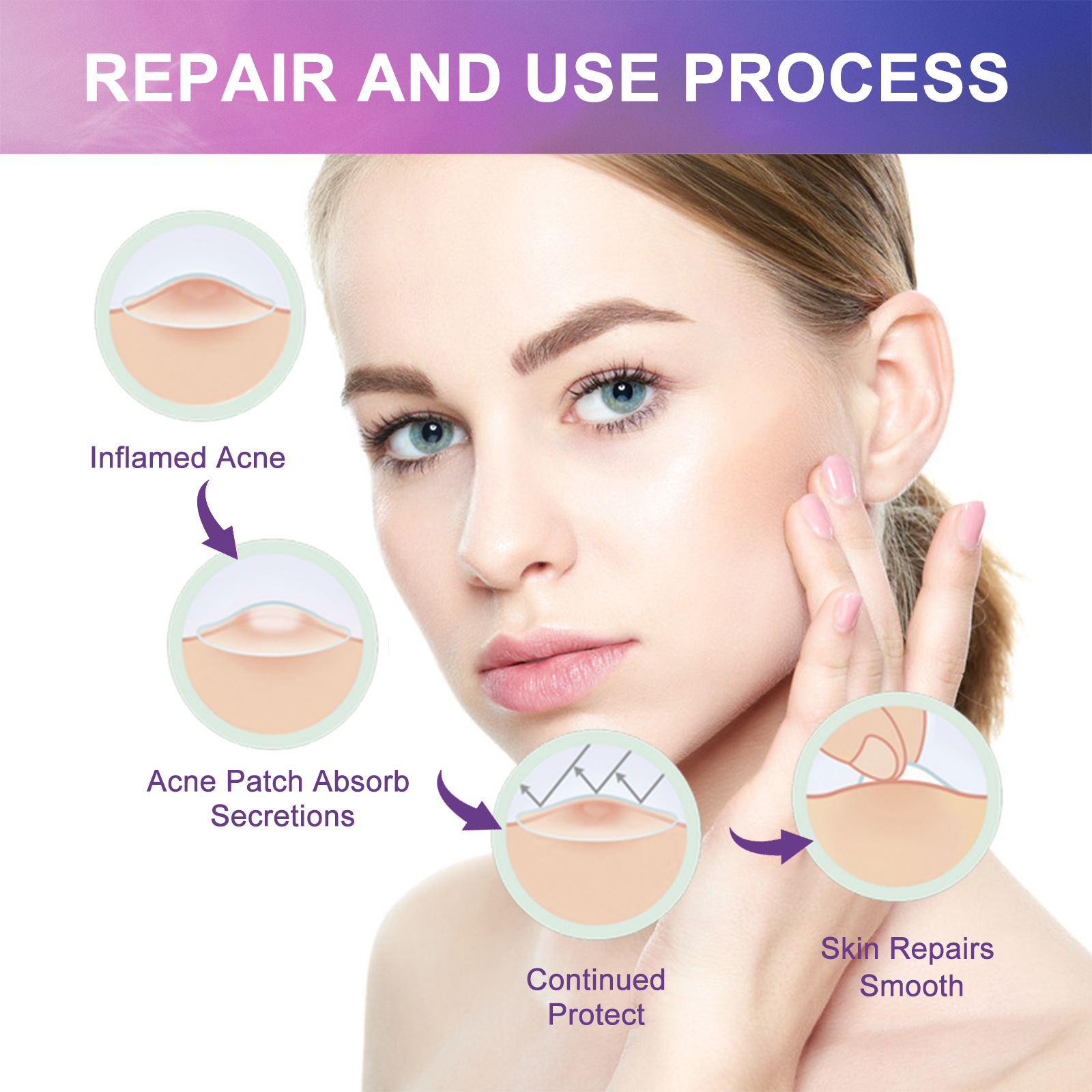 Patch hydrogel acné jaysuing pour atténuer les taches et boutons_voghion.com