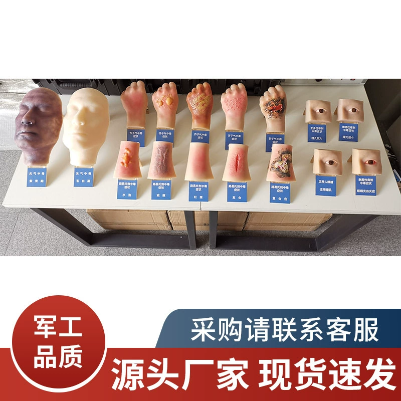 Моделирование персонала модели отравления (включая витрину)