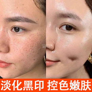 Beauty Salon Color Control Cream Decomposes Darkening Marks, Whitens, Removes Spots, Inhibits Pigment, Reflux, Improves Dullness and Color Removal Cream