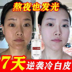 377 ホワイトニング エッセンス、保湿、保湿、濃い黄色、肌のトーンを改善、美白、そばかす除去、高濃度ナイアシンアミド オリジナル ソリューション