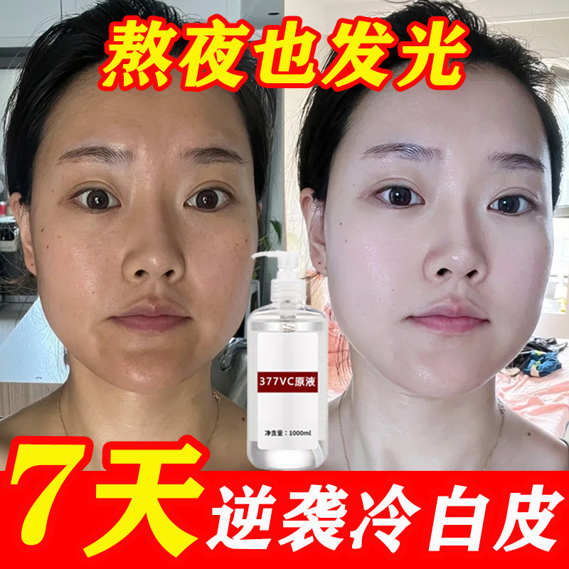 377 ホワイトニング エッセンス、保湿、保湿、濃い黄色、肌のトーンを改善、美白、そばかす除去、高濃度ナイアシンアミド オリジナル ソリューション|undefined