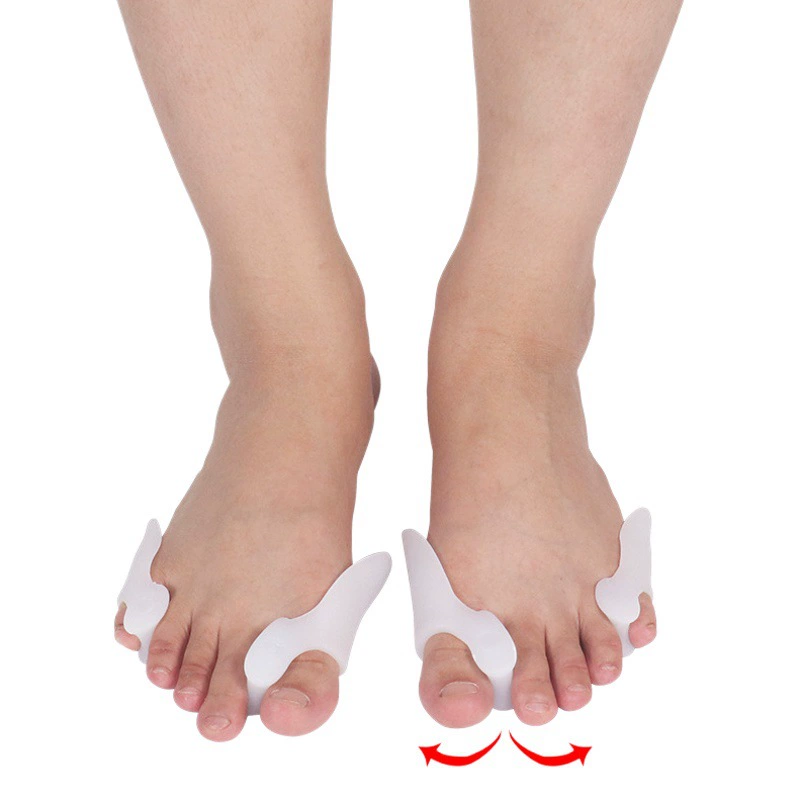 Ортодонтическое устройство для вальгусного стопы сепаратор для пальцев ног Ортодонтическое силиконовое ортодонтическое устройство