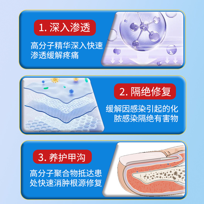 足の爪の赤み、腫れ、液の出る状態、爪周囲の腫れ、痛み、巻き爪、肉に埋まる爪の予防、液の出る状態の爪の治療、外用軟膏|undefined