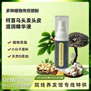 ���`֥��ɣ�غ���轺ڶ��ڸ��Ӻ��מ��^�l�^Ƥ���AҺ���װl�I�BҺ