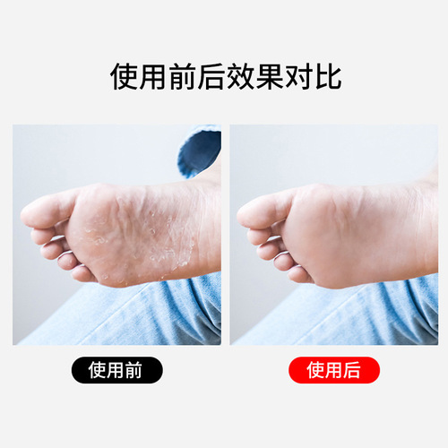 Factory wholesale stainless steel foot scrubbing to remove dead skin, cuticles and calluses artifact, foot scrubbing without hurting feet, double-sided foot scrubbing board