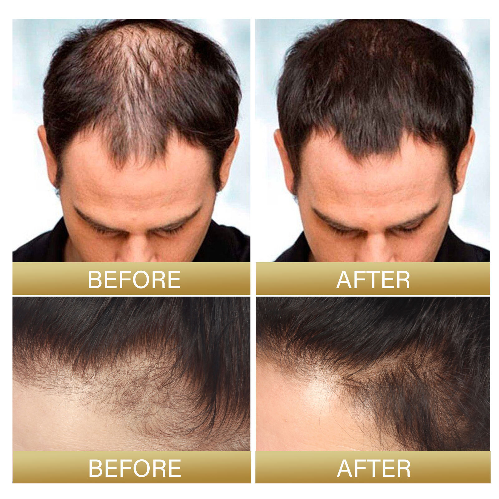 Spray capilar Batana de EELHOE que hidrata profundamente el cuero cabelludo, repara el cabello y lo fortalece. Spray capilar fortalecedor_voghion.com