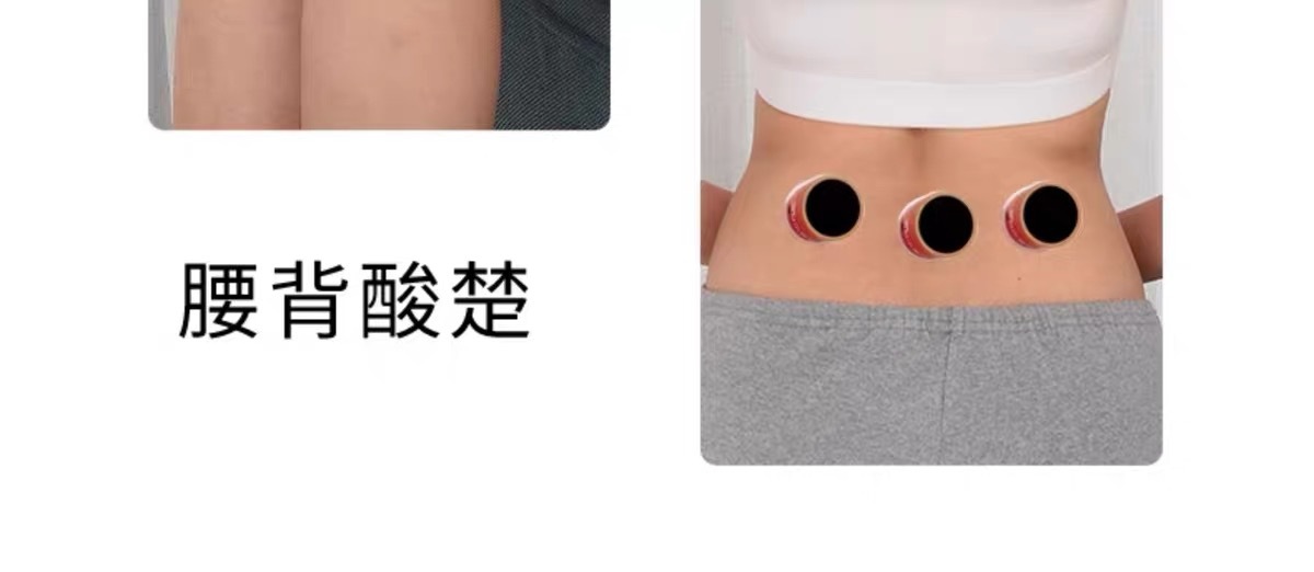 Moxibustion Tube Mini Smoke-Less Ai Jiu Canister with 30 Adhesive Patches for Warming Massage Care in use