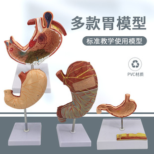 1.5倍胃模型 胃解剖模型 胃解剖结构标本 消化器官 仿真人体内脏-阿里巴巴
