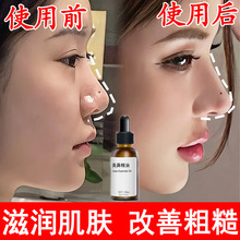 ���Ǿ������߱���ԭҺ�sС�������Ӿ��AҺ��ͦ�����������S�����l