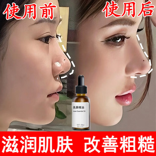 ���Ǿ������߱���ԭҺ�sС�������Ӿ��AҺ��ͦ�����������S�����l