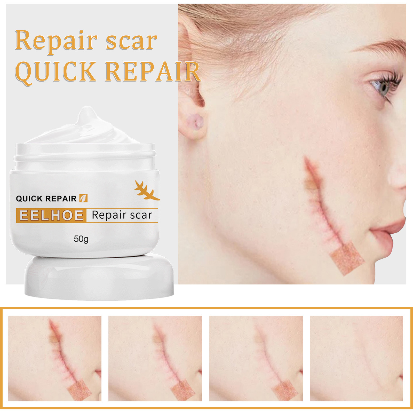 EELHOE Scar Cream Fading Hud Trauma Reparation Forbrænding Forbrænding Fading Cream Kirurgisk reparation Scar Scar Cream_voghion.com