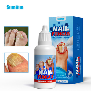 sumifun���uͨ�羳ָ��Һ���ˮܛ��Ó���㲿�o������ҺK60001