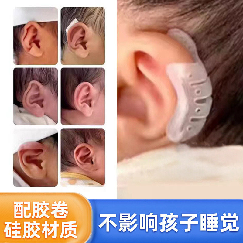 Silicone Baby Ear Corrector Auricle Orthopedics Newborn Deformity Ear Shape Droopy Ear Correction Newborn Correction Silicone Baby Ear Corrector Auricle Orthopedics Newborn Deformity Ear Shape Droopy Ear Correction Newborn Correction
