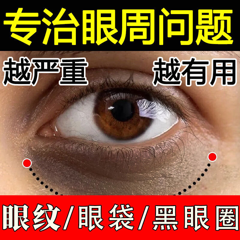 Ultrasonic Eye Cream for Anti-Wrinkle, Fine Lines, Dark Circles, and Eye Bags, Lifting and Firming, Beauty Salon Eye Care Products Wholesale