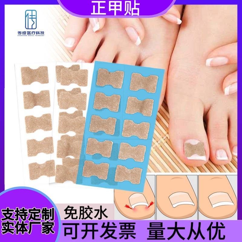 Manufacturer's Cross-Border Nail Correction Stickers, Glue-Free Toenail Correction Stickers, Nail Repair Stickers, Nail Groove Correction Stickers