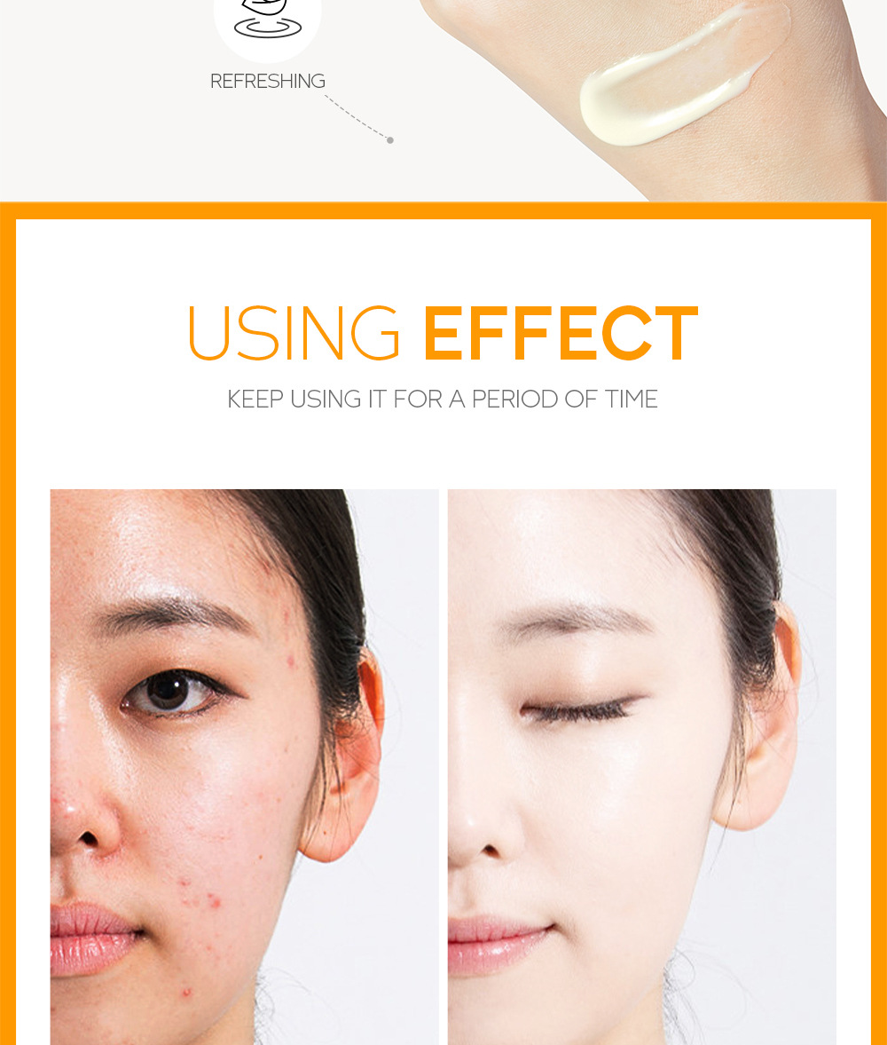 FENYI Vitamin C Cream 40g Hydrating and Moisturizing Cross-border Shrimp Skin Care Products and Cosmetics wholesale undefined