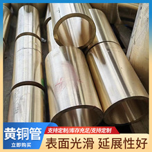 �S��ֱ�NH62�S�~��С�ڏ�����H63�S�~�ܱ���ë���ܾ��ܹ�Ҏ���Rȫ