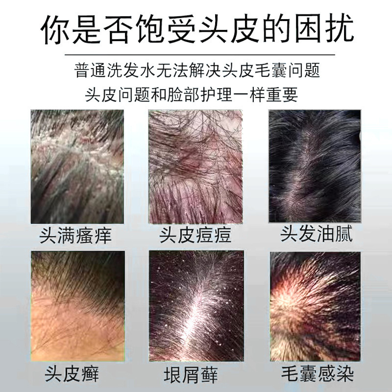 芙诗婷煤焦油洗剂洗发液洗发水厂家批发抖音爆款代发|undefined