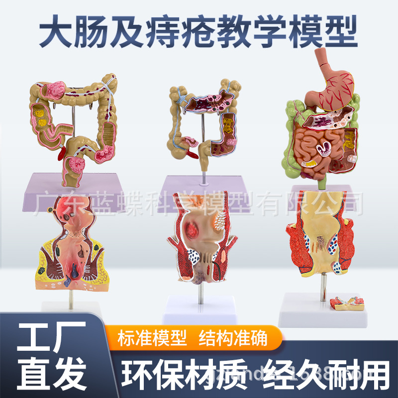 ֱ���̴��󳦽᳦����ģ�� ����ֱ���̴����Ÿس���ģ��ֱ������