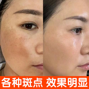 Herbal Astragalus Cream Genuine Old-Fashioned Domestic Brushed Whitening Freckle Cream to Remove Chloasma Freckles Day Cream Night Cream