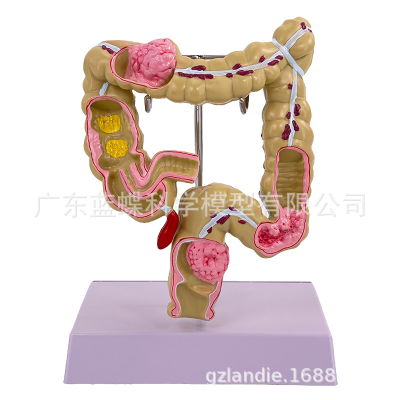 ֱ���̴��󳦽᳦����ģ�� ����ֱ���̴����Ÿس���ģ��ֱ������