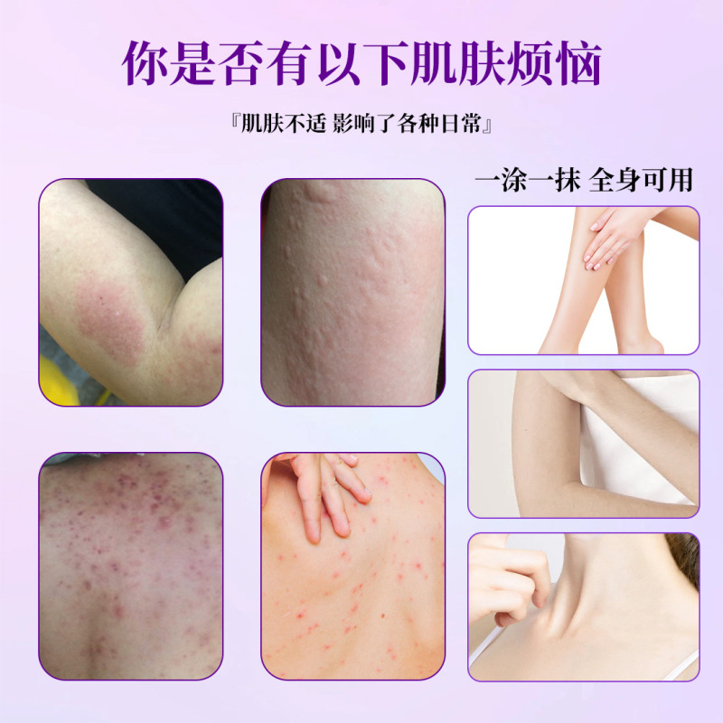 香港大薬局紫花地丁膏家庭用皮膚外用かゆみ止めクリーム卸売り草本クリームのかゆみ止めクリーム代発|undefined