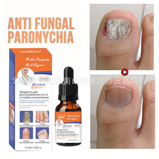 Cross-Border English and Russian Nail Care Essence Daily Hand and Foot Cleaning Black and Yellow Onychomycosis Soft Nail Rotten Toe Nail Potion