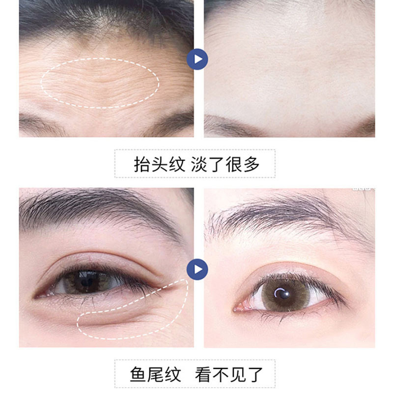 涂抹式肉毒芽孢杆菌原液紧致抗老淡化细纹面部提拉抗皱精华液|undefined