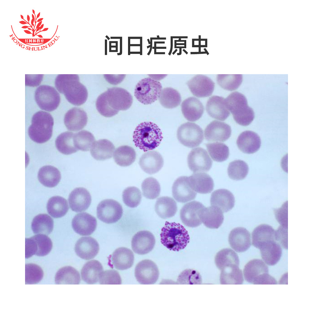 间日疟原虫标本玻片病理血抹片医学寄生虫厚薄血膜同片吉姆萨染色-阿里巴巴