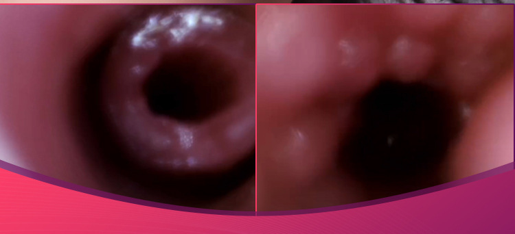 Male Masturbator Realistic TPE Vagina and Buttocks Manual Adult Toy — detail image 9