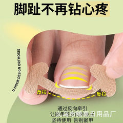 指甲修复拉拉贴免胶水快速修脚趾甲变形贴片脚指甲防嵌甲矫正胶贴