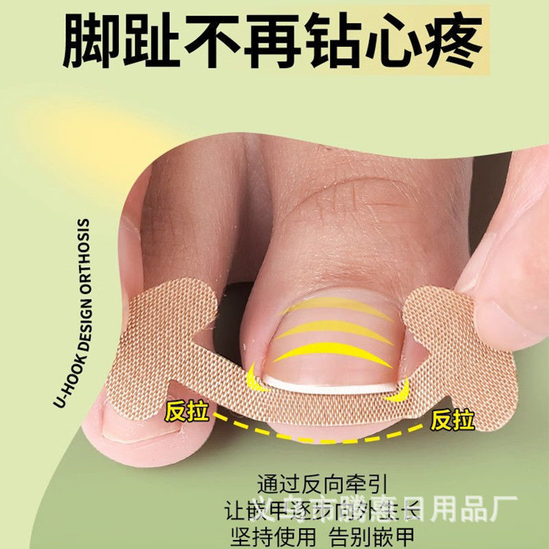 指甲修复拉拉贴免胶水快速修脚趾甲变形贴片脚指甲防嵌甲矫正胶贴|undefined