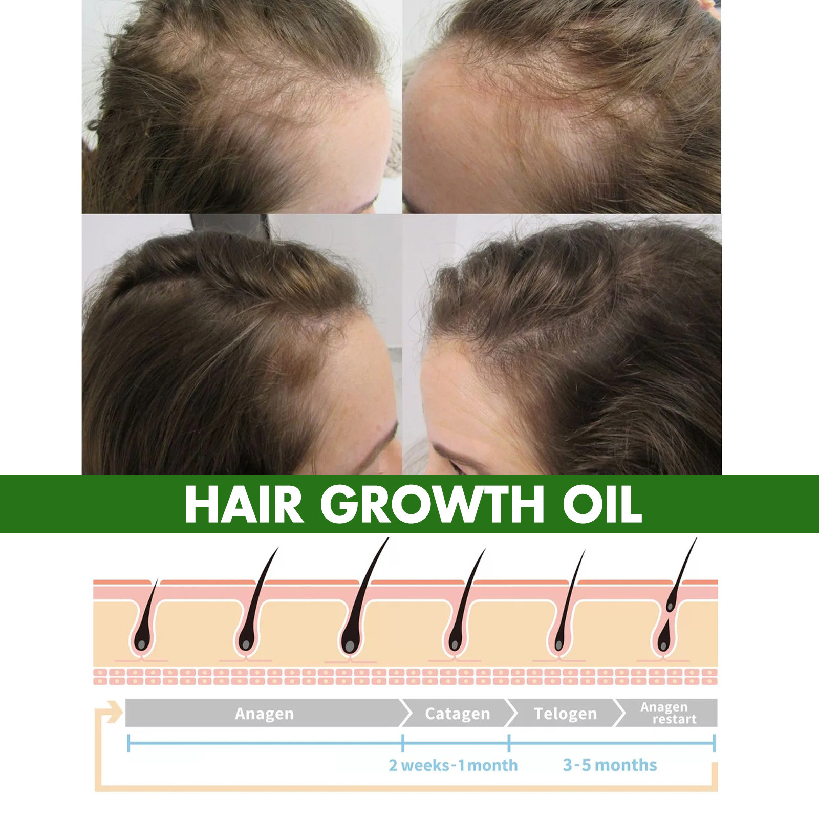 EELHOE Moisturizes, Firms, and Nourishes Dense Scalp Hair Care Essential Oil_voghion.com