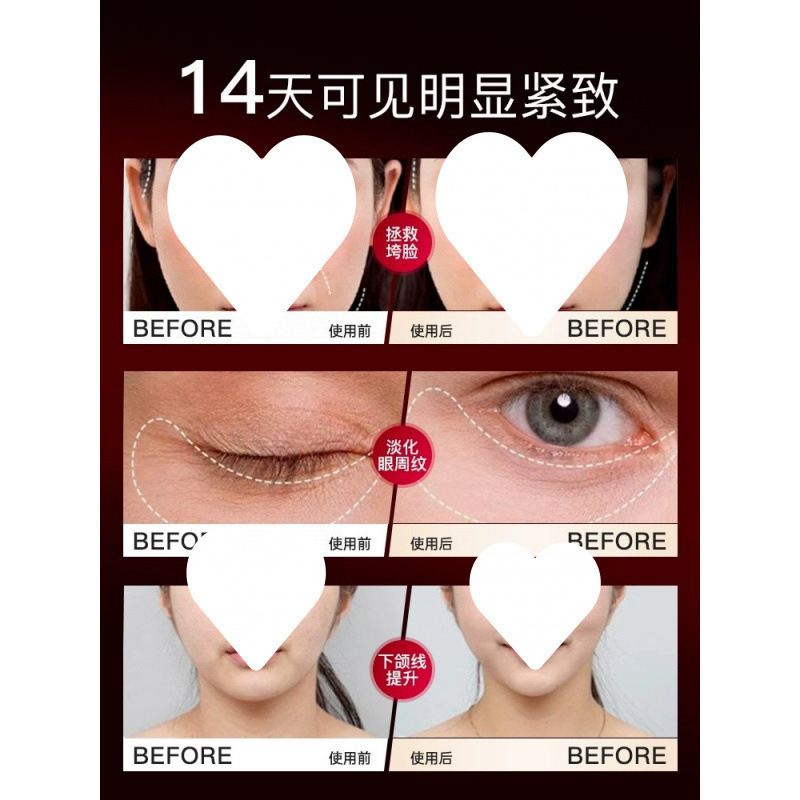 大熨斗美容仪器家用脸部提拉紧致按摩胶原炮射平面部精华频导入仪|undefined