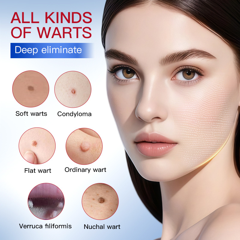 SADOER Warzenflüssigkeit, Maulwurfentfernung, glatte, makellose Haut, Absorptionsessenzstift_voghion.com