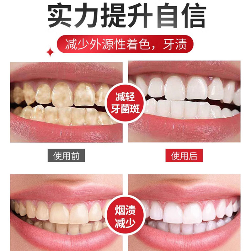 水果小蘇打牙膏 SP-4益生菌牙膏批發清新口氣家庭裝 工廠代發