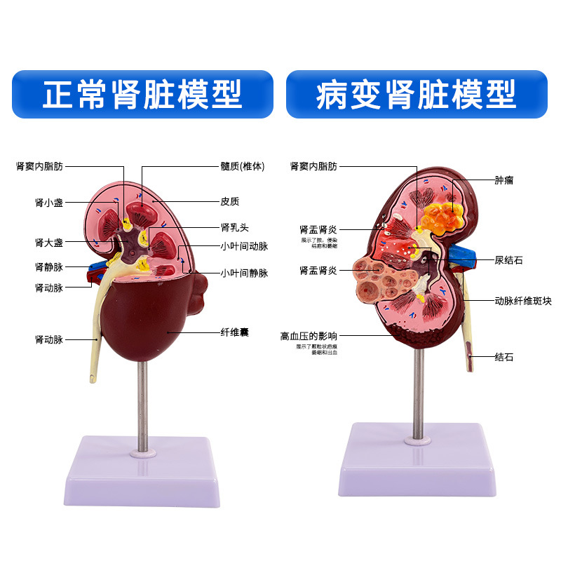 ����������ģ��,��������ģ�� ����ģ�� �����������ٽ���ģ��