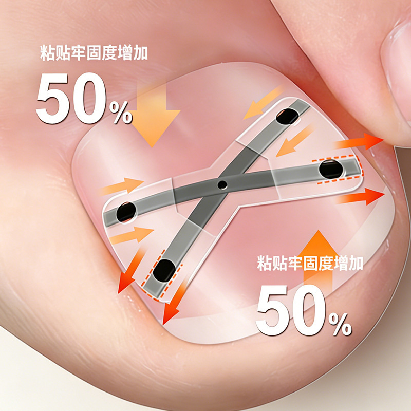 X-Shaped Nickel-Titanium Alloy Bionic Bone Patch for Ingrown Toenail Correction, Toenail Inflammation Corrector