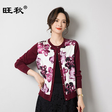 ��Sֱ�Nɣ�Q�zᘿ��_��ӡ��ƴ���������A�I��z����J62542