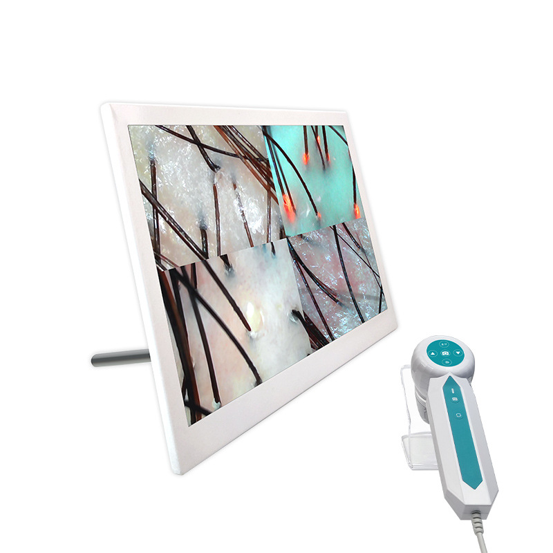 Instrumento de detección de cuero cabelludo pérdida de cabello folículo 3 espectro HD analizador peluquería salón de belleza instrumento de prueba de la piel