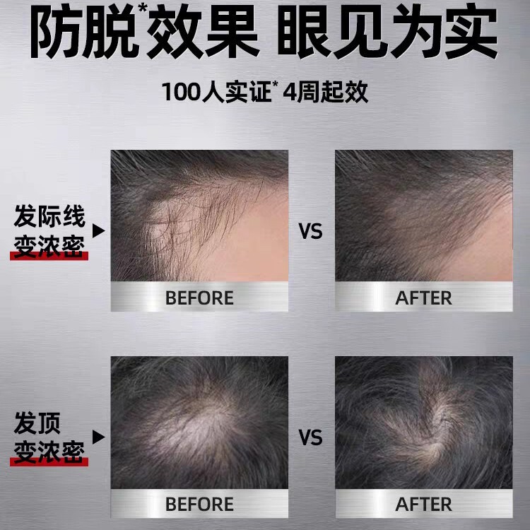 德国欧倍菁C1鸥贝青滋养控油咖啡因防脱洗发水250ml无硅油去屑|undefined