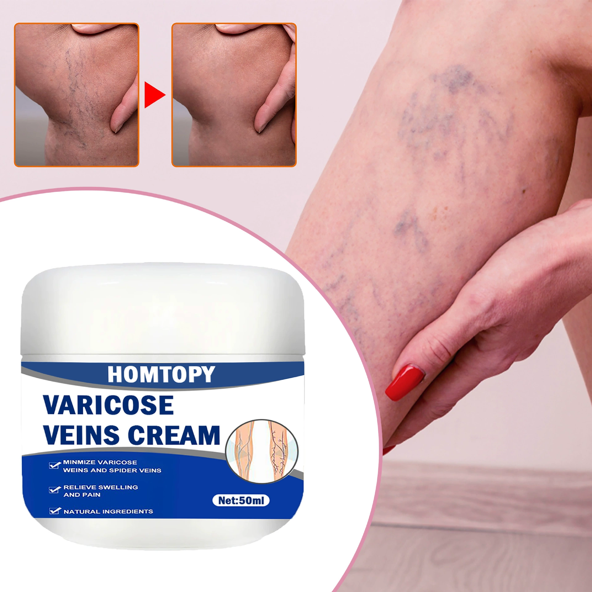 Новый трансграничный продукт HOMTOPY крем для массажа вен, крем для восстановления ног, успокаивающий крем, восстанавливает, питает и разглаживает кожу.