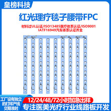 660nm ����������� FPC PCBA ��·��羳����ñ�����������Ƕ���