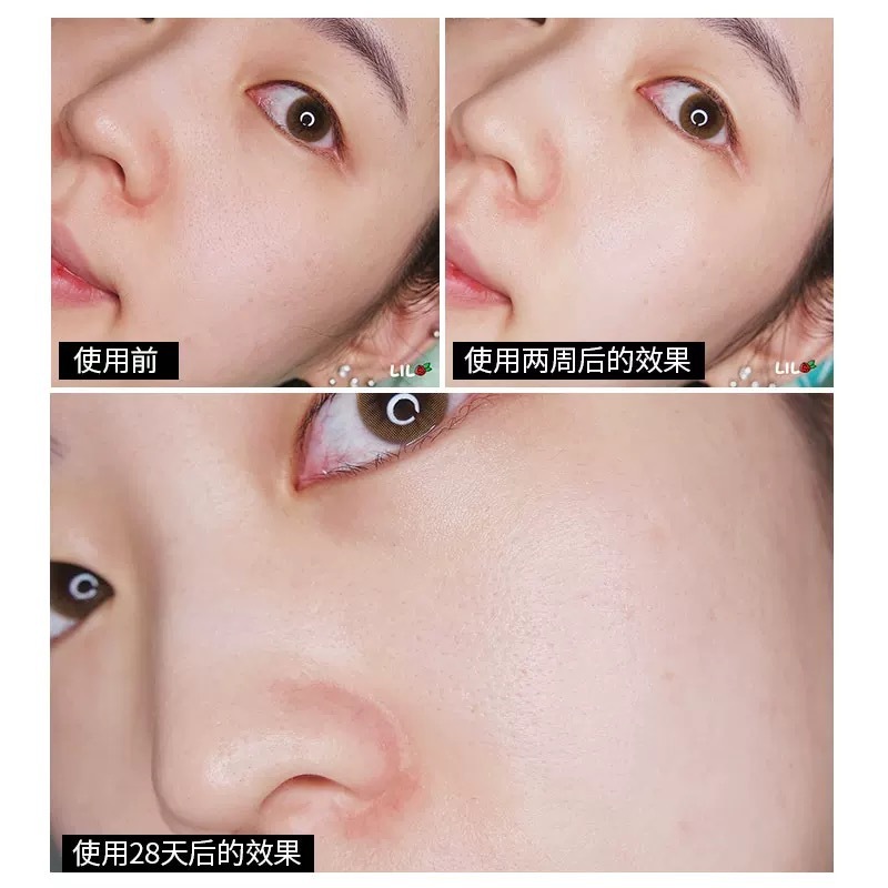 Qianjia 302 ホワイトニングレーザーエッセンス Zhuoyan マルチエフェクトホワイトニングエッセンス 50 ミリリットル/100 ミリリットル抗しわ栄養|undefined