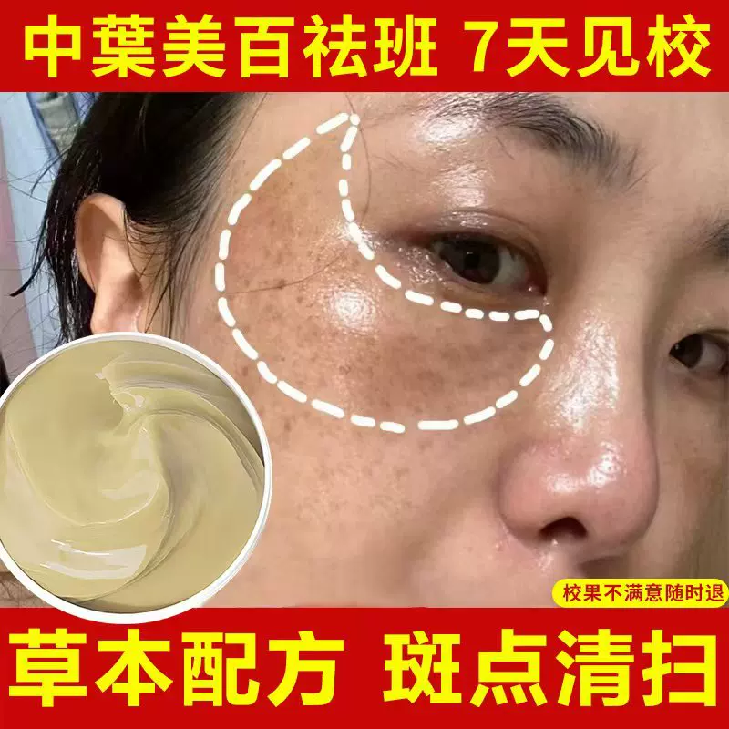 祛斑霜草本祛斑美白补水保湿面霜淡化色斑老年斑黄褐斑淡斑霜批发