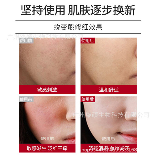 Squalane B5 Repair Cream Sensitive Skin Repair Cream Remove Redness Soothing Redness Skin Barrier Hormone Face Cream