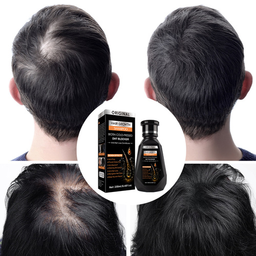 Disaar Cross-border Ginger Shampoo Cleansing Hair Firming Hair Care Wholesale Hair Growth Shampoo